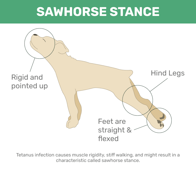 Sawhorse Stance, characteristic of generalized Tetanus infections