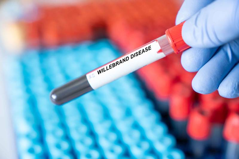 Willebrand Disease disease blood test inmedical laboratory