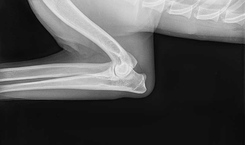 x ray of elbow dysplasia